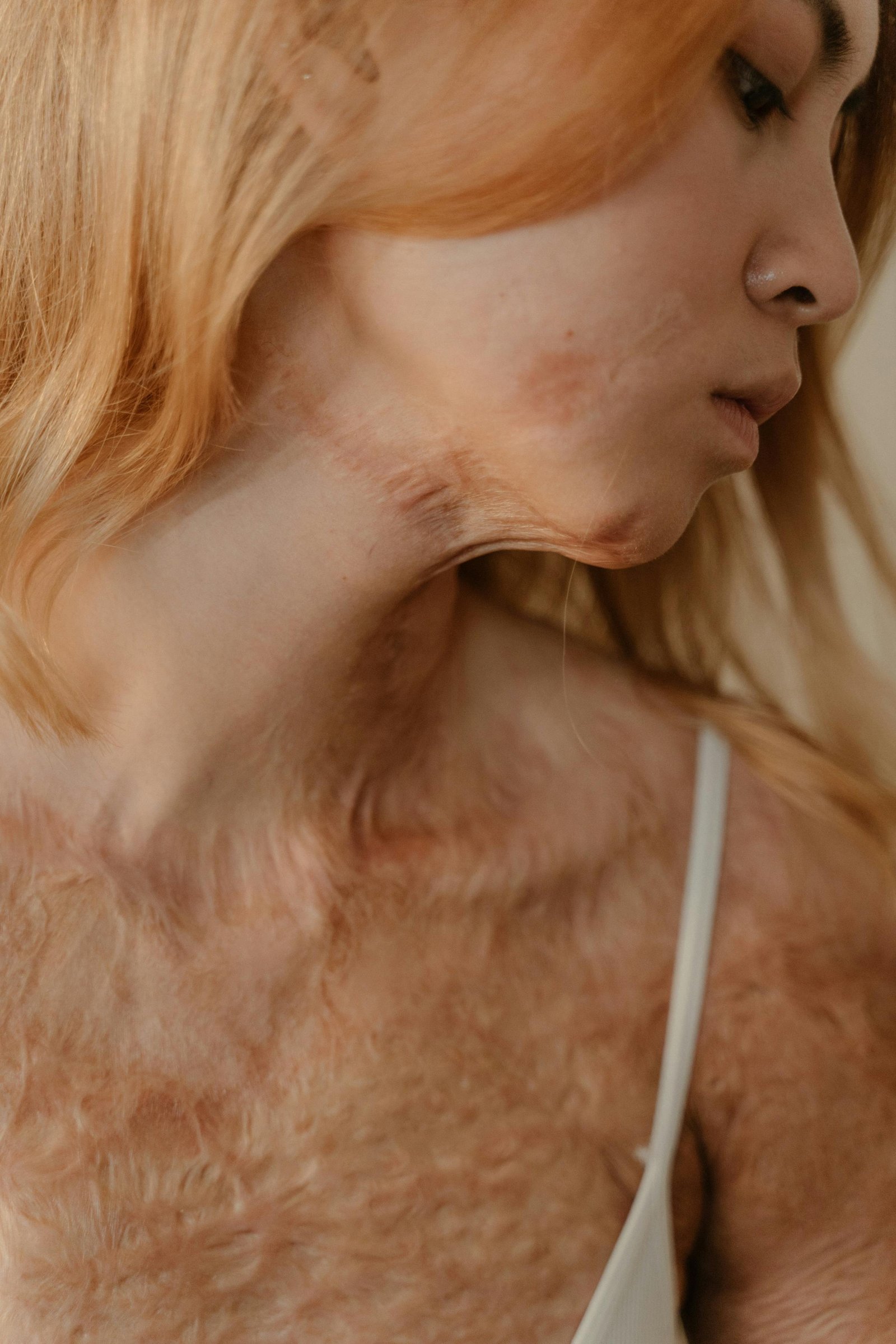 Scar & Mark Removal